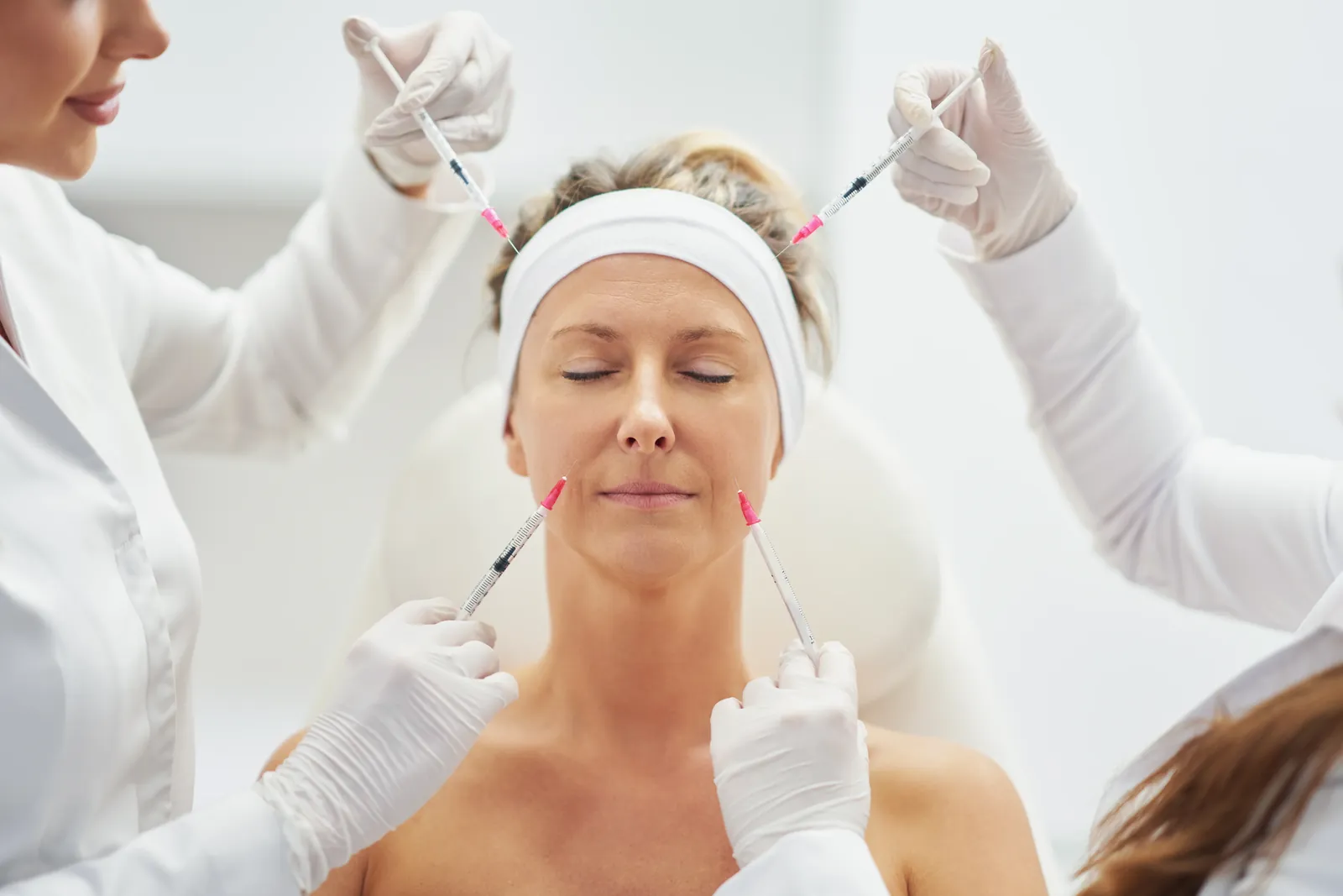 Dermal fillers immediate results