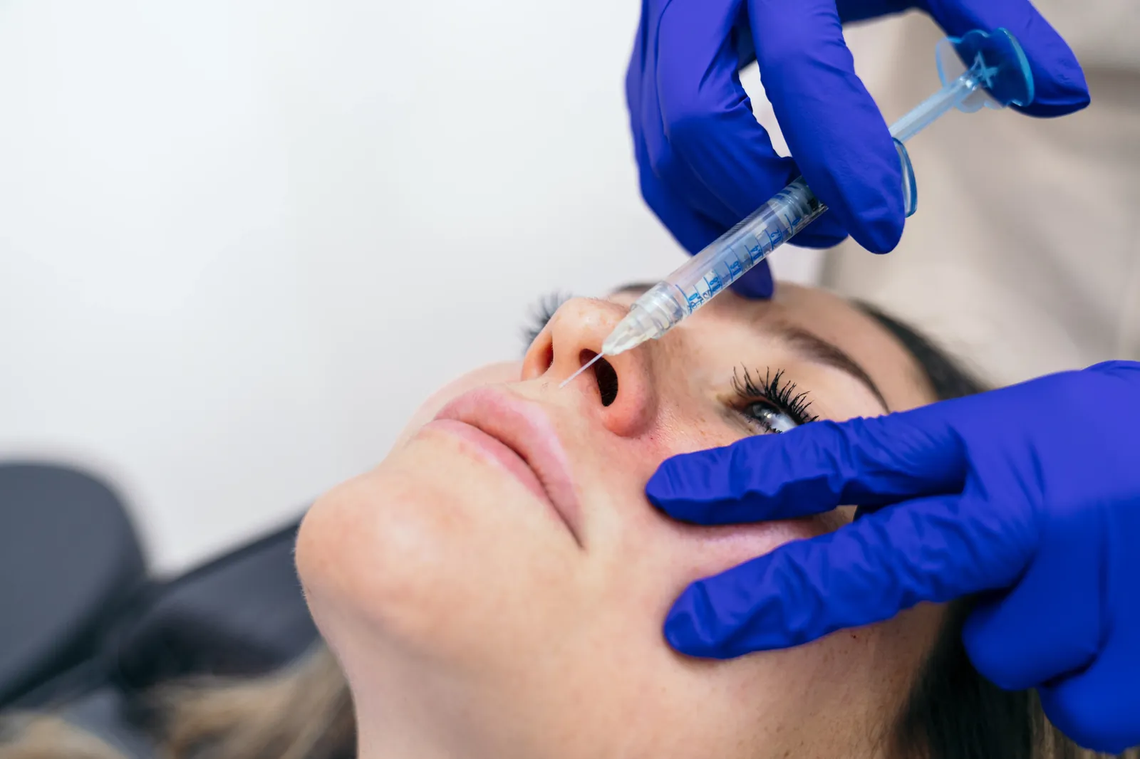 Dermal Fillers restore lost volume
