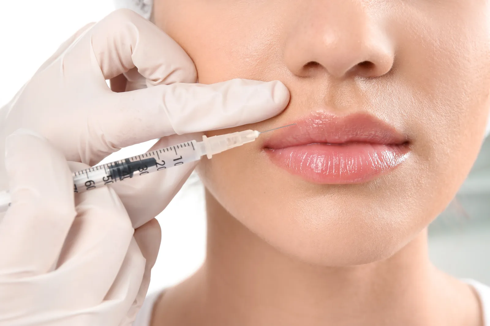 Dermal fillers reversible