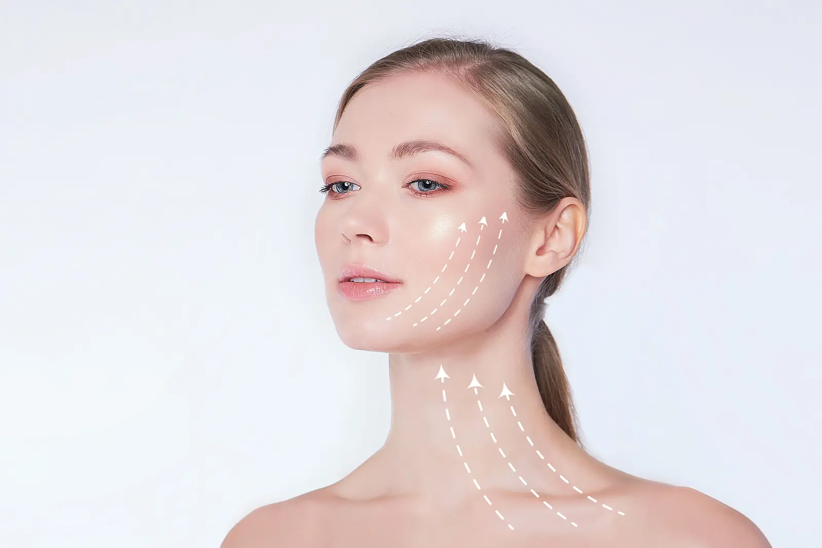 Thread Lift improves skin firmness