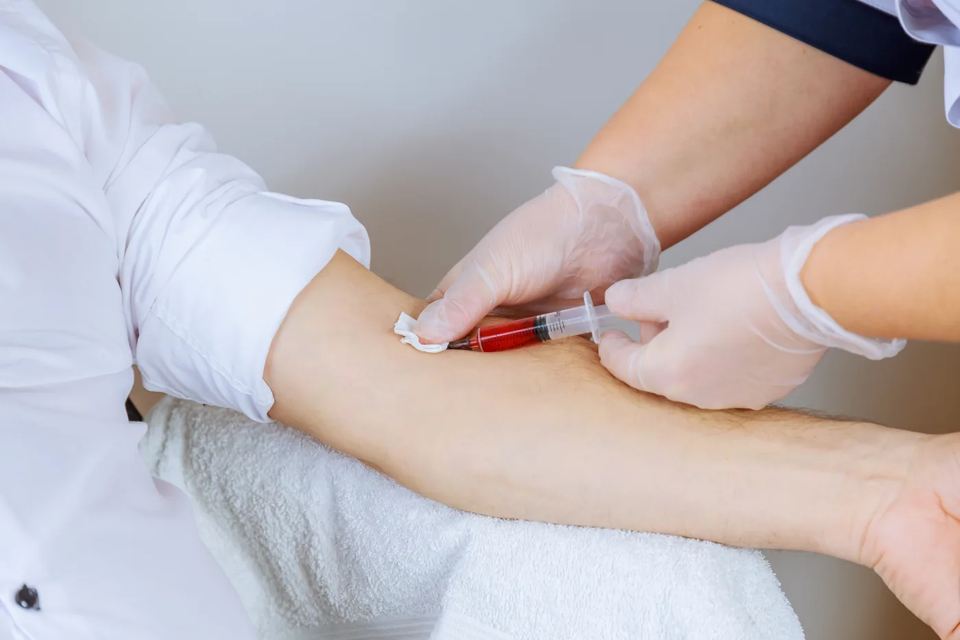 GFC Therapy as PRP plateau upgrade