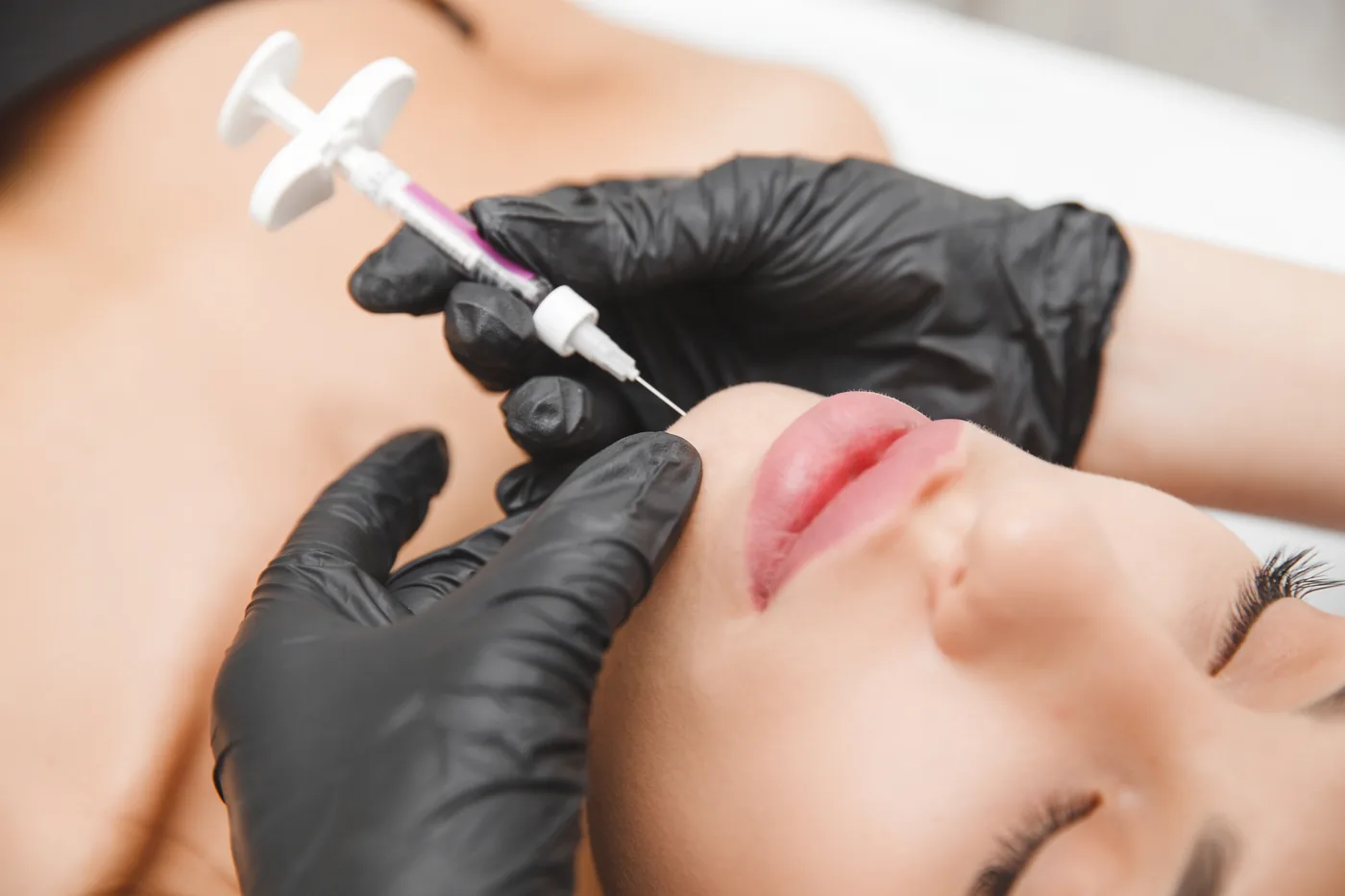 Dermal Fillers Treatment at Aevum Health Goregaon West Mumbai