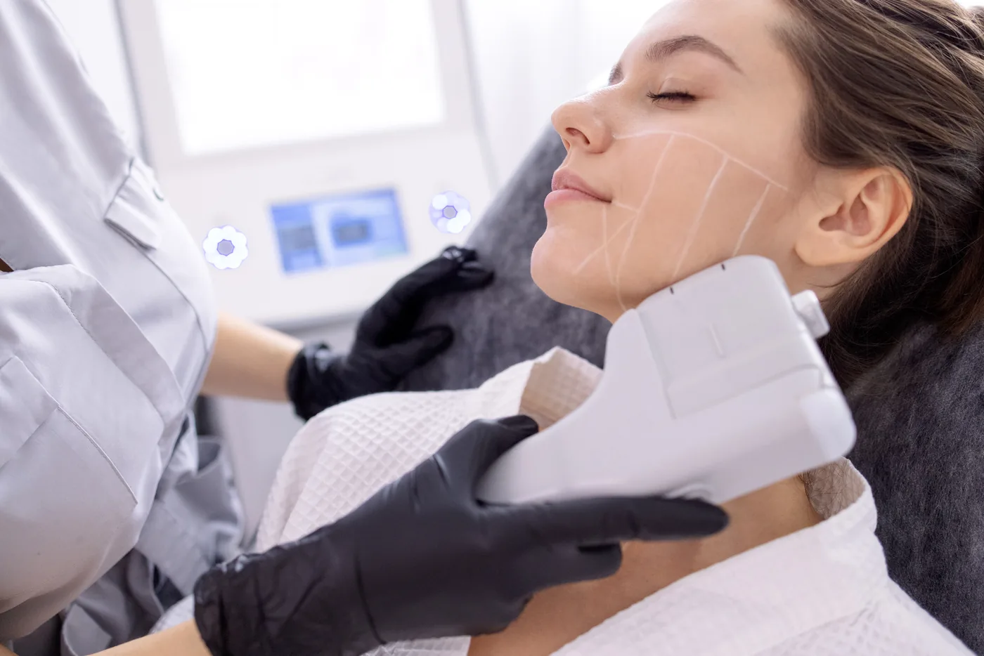HIFU for mild to moderate skin laxity and sagging