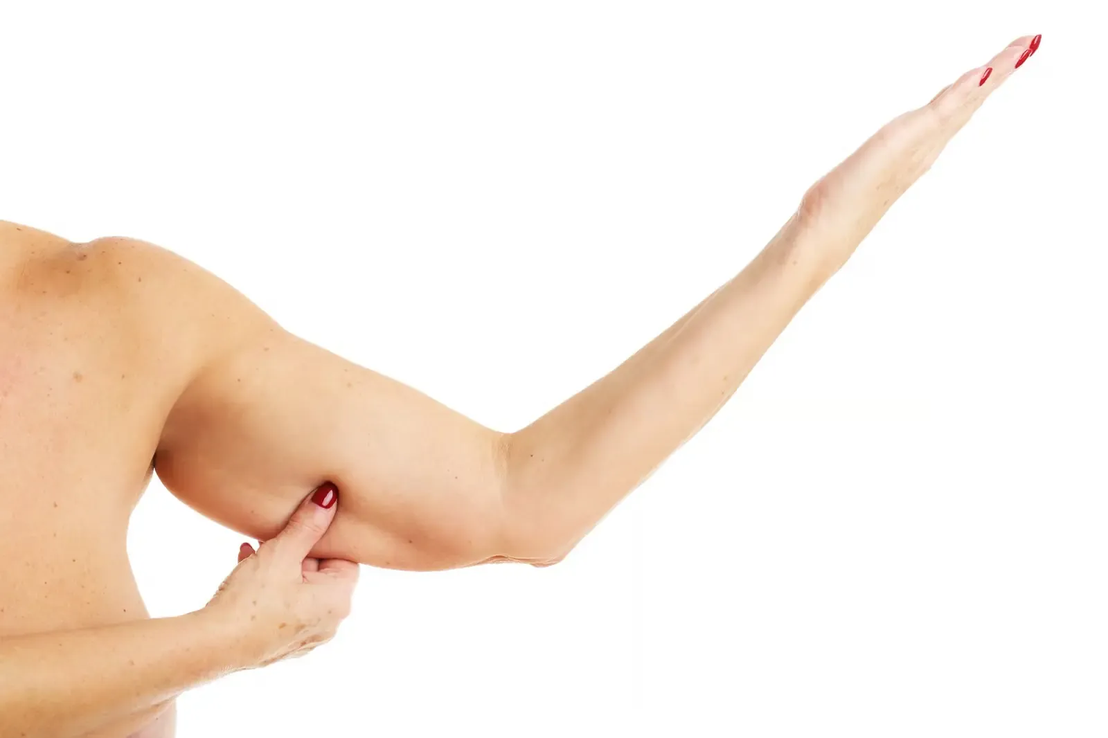Radio Frequency for upper arm and inner thigh laxity