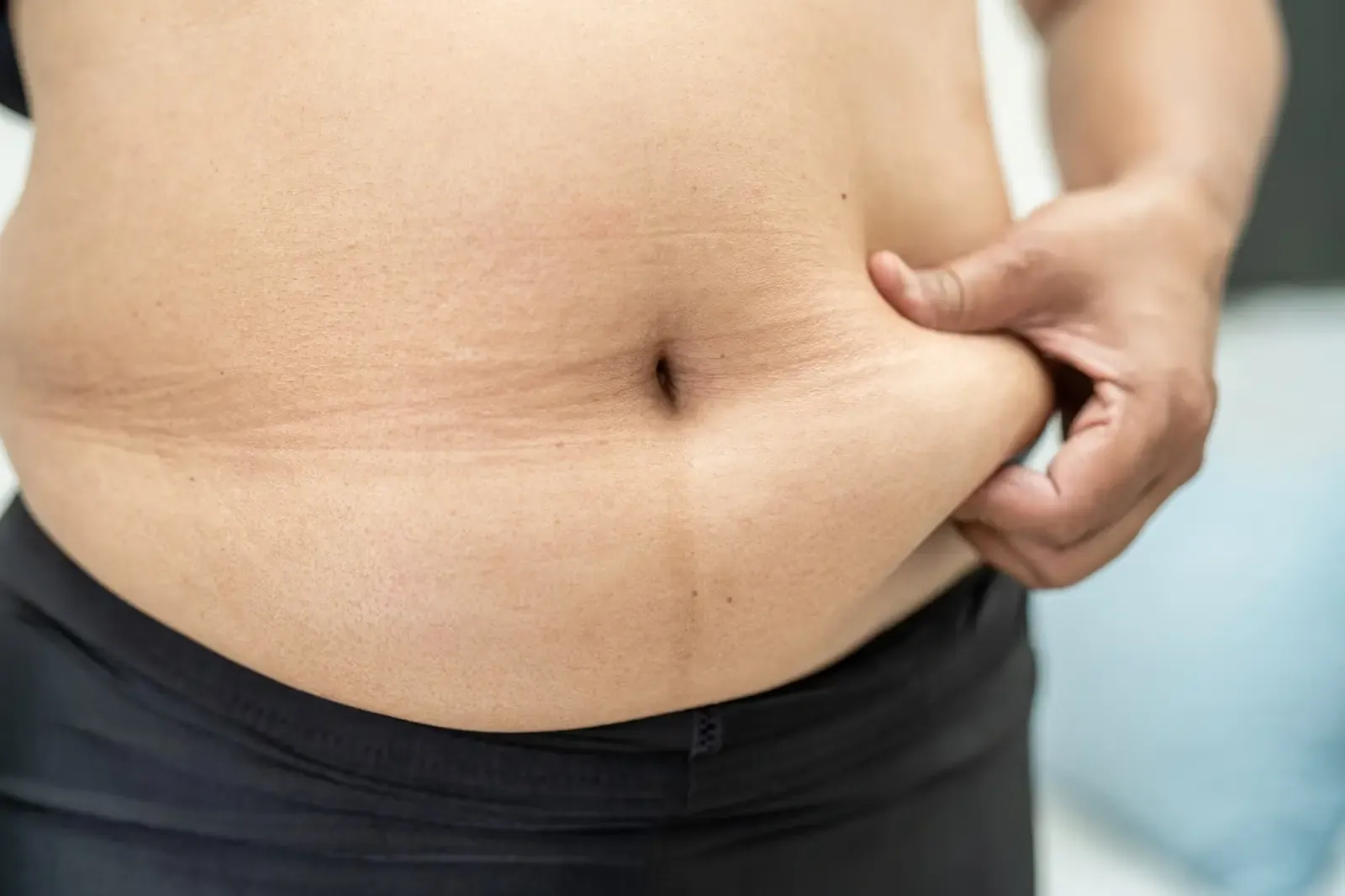 Radio Frequency for post-weight-loss loose skin