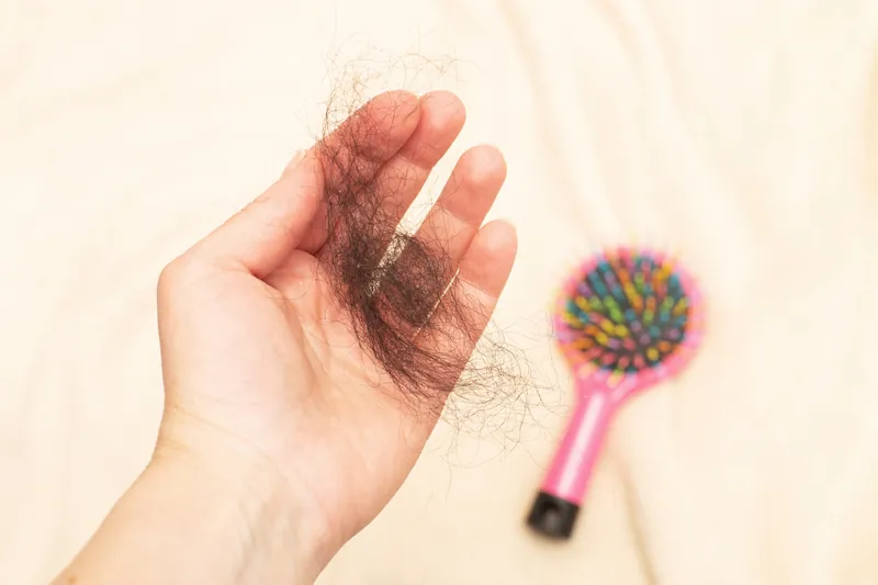 Hair Fall & Hair Loss