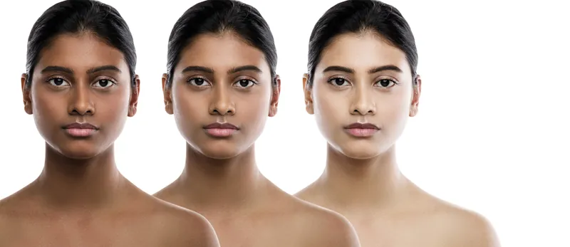 Skin Lightening